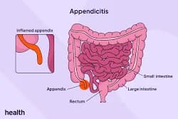 What the Appendix Taught Me About the Limits of Medical Certainty · Medical Guide by Famicare Speciality Center